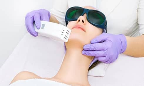 Epilazione laser definitiva del viso